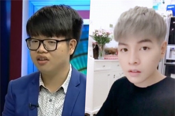 Sốc với số tiền Đức Phúc chi trả cho ca phẫu thuật thẩm mỹ