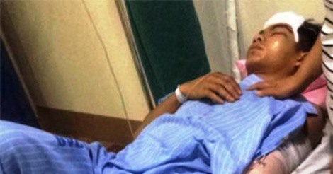 Cán nát tay bí thư chi đoàn, tài xế xe ôtô bỏ trốn khỏi hiện trường