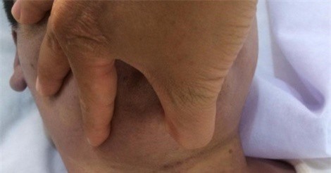 Học viên cai nghiện chết treo cổ trong nhà vệ sinh