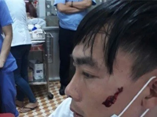Đắk Lắk: Điều dưỡng bị người nhà cầm dao đâm rách mặt