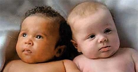 Lần đầu tiên phát hiện cặp song sinh khác cha ở Việt Nam