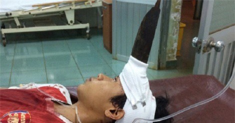 Tặng bằng khen 2 bác sĩ cứu sống bé trai bị dao găm giữa trán