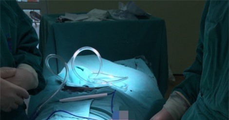 Sản phụ vừa sinh cắt toàn bộ vú phải vì khối u khủng