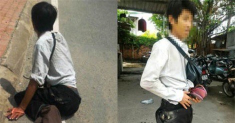 Vạch trần thủ đoạn của thanh niên giả tàn tật bán vé số trên cầu Bình Triệu