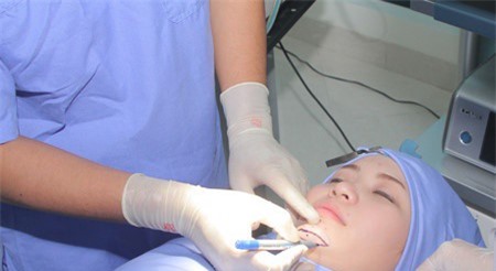 Phẫu thuật gọt cằm, một phụ nữ tại TP. HCM nguy kịch