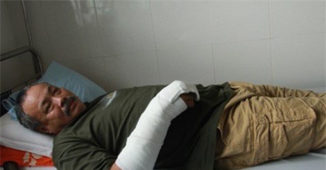 Bị bắt quả tang, trộm xuống tay đâm chủ nhà 7 nhát dao rồi tẩu thoát