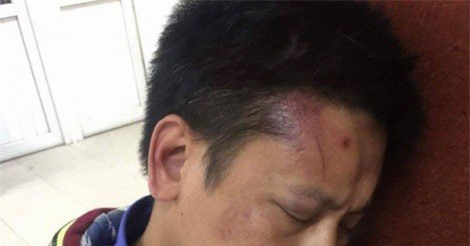 Bảo vệ Bệnh viện Phụ sản Hà Nội bị tố đánh người nhà bệnh nhân