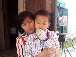 Làm rõ vụ việc cô giáo đánh gãy ngón tay học sinh 5 tuổi
