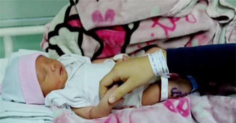 Mổ khẩn cấp cứu bé trai bị dây rốn quấn 4 vòng quanh cổ