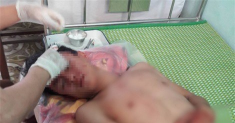 Làm rõ nhóm đối tượng vào trường học đánh thầy trò nhập viện