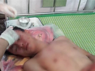 Làm rõ nhóm đối tượng vào trường học đánh thầy trò nhập viện