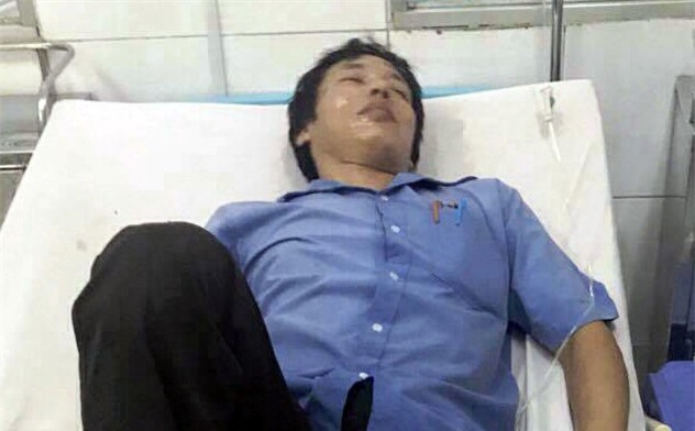 Đồng Nai: Hệ thống điện phát nổ, hàng chục công nhân nhập viện