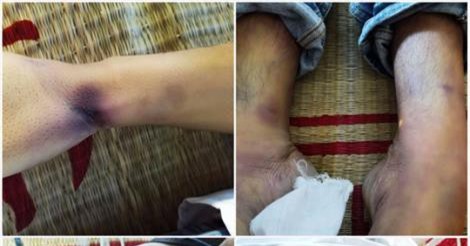 Tiền Giang: Nguyên nhân nam thanh niên tử vong tại đồn công an 