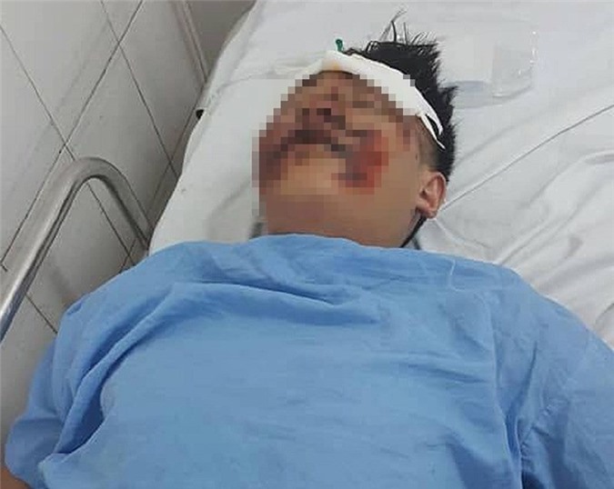 Trích xuất camera, truy tìm tài xế ôtô tông 2 sinh viên rồi bỏ trốn