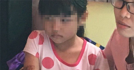 Vụ bé gái nghi bị cha dí sắt nóng vào mặt: Cha đẻ và mẹ kế lên tiếng