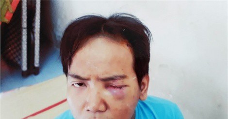 Rùng mình trước lời khai của bảo vệ dân phố sát hại bé trai 6 tuổi