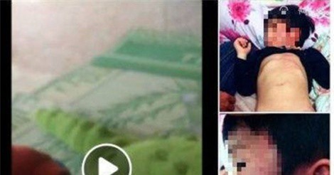 Diễn biến mới nhất vụ bé gái 4 tuổi bị bầm tím ở lớp