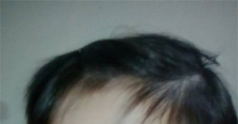 Mẹ bé trai 10 tuổi bị bạo hành: “Gặp con, tôi không nhận ra nữa”