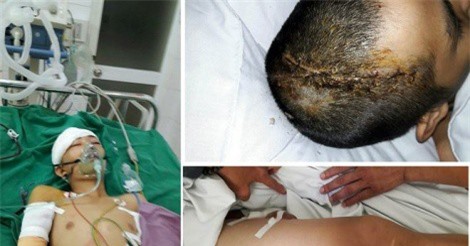 Nam thanh niên bị chủ nhà chém liệt nửa người nói gì?