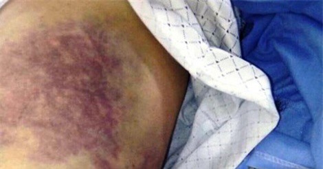 Nghịch tử đánh bố mẻ bánh chè, gãy xương sườn ở Nghệ An