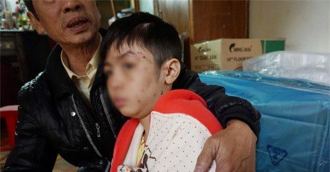 Vụ bố đẻ và mẹ kế bạo hành cháu bé 10 tuổi: Chủ tịch UBND Hà Nội yêu cầu xử nghiêm