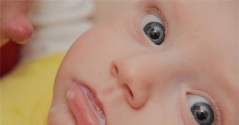 5 cách giúp trẻ không bị nôn trớ