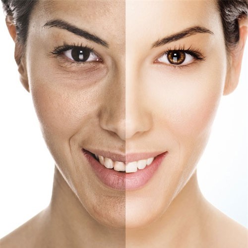 7 cách tự nhiên làm săn chắc vùng da bị chảy xệ