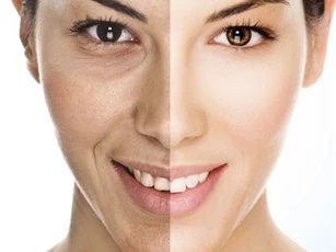 7 cách tự nhiên làm săn chắc vùng da bị chảy xệ
