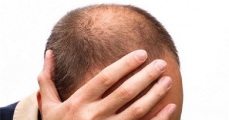 Tổng hợp sinh hóa tạo chất giúp tóc mọc lại