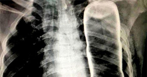 Những ca bệnh hy hữu ở Việt Nam năm 2017