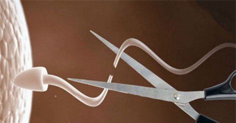 Gel tránh thai mới dành cho nam giới sắp được thử nghiệm