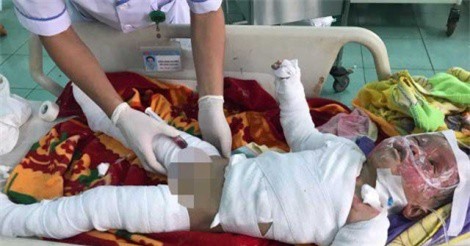 Hai anh em nghịch lửa khiến nhà cháy rụi, một cháu bé tử vong