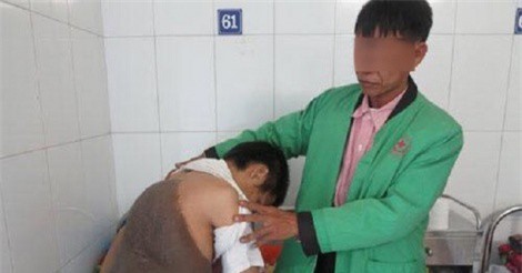 Bệnh viện Việt Đức: Giải thoát cho thanh niên 26 tuổi khỏi tấm "mai rùa" khổng lồ