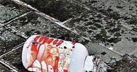 Con dâu nhập viện cấp cứu vì bị mẹ chồng tạt axit 