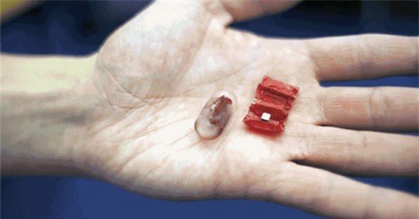 Clip: Robot có thể lấy dị vật ra khỏi cơ thể không cần phẫu thuật