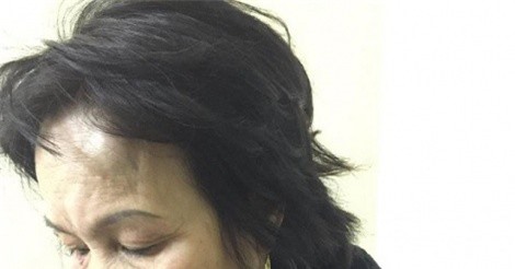 Tranh chấp đất, chủ quán ăn bị cháu họ đánh nhập viện