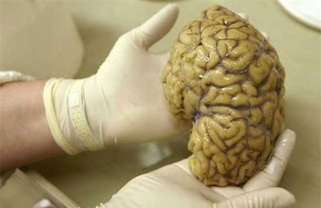 Bí mật rợn người về bộ lạc ăn thịt người ở Papua New Guinea