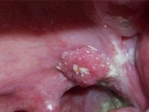 Cánh mày râu phải làm gì trước nguy cơ “virus phụ nữ” tấn công?