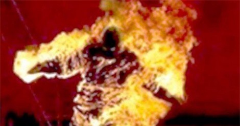 Đồng Nai: Người đàn ông châm lửa tự thiêu sau khi cãi nhau với vợ