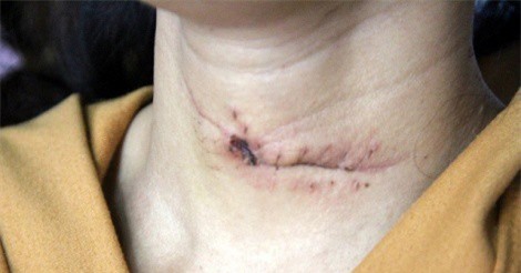 Đăk Nông: Dùng dao "cứa" cổ người tình rồi tự tử