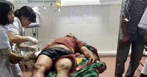 Mâu thuẫn chia tiền công xây nhà, thợ xây bị đồng nghiệp chém xối xả