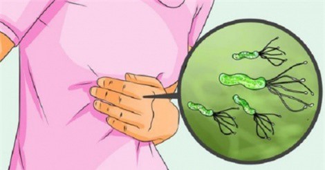 Vi khuẩn HP gây biến chứng ung thư dạ dày