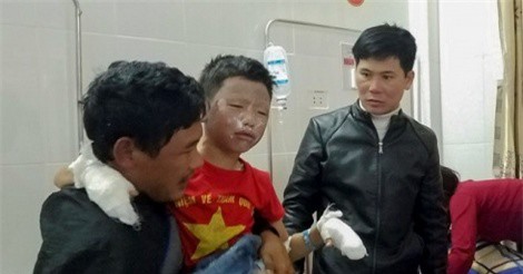 Đứng xem rán xúc xích, 7 học sinh nhập viện vì nổ bình gas mini