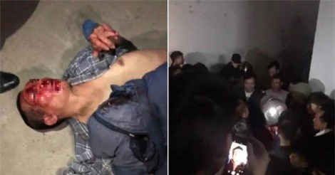 Hà Nam: Nghi bắt cóc, người đàn ông bị đánh nhập viện