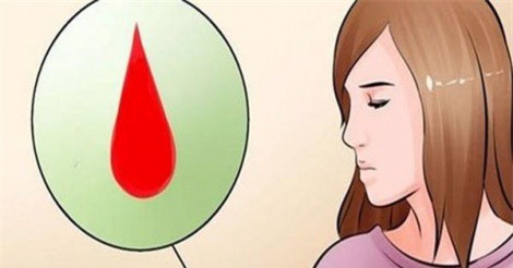 Cách nhận biết tình trạng sức khỏe qua màu sắc kinh nguyệt chị em cần biết