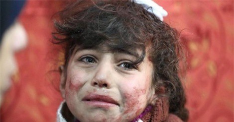  Chảo lửa Damascus: Phiến quân Syria bắn phá trường học, 3 trẻ em chết thảm 