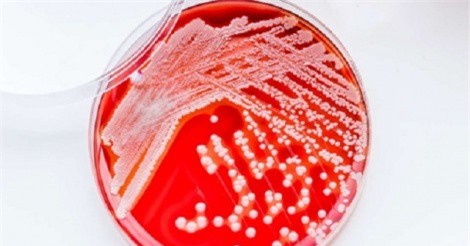 Bất ngờ với loại thuốc kháng sinh mới có nguồn gốc từ đất