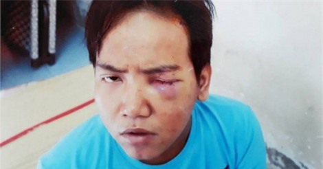 Bảo vệ dân phố sát hại bé trai 6 tuổi ở Sài Gòn bị tâm thần phân liệt