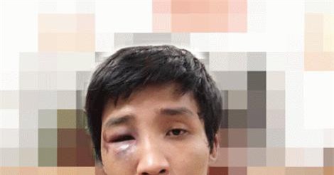 Hà Nội: Bắt đối tượng côn đồ chuyên quậy phá, gây rối cả xóm