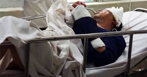 Lâm Đồng: Chơi nhạc ở đám cưới về, thầy giáo bị chém trọng thương